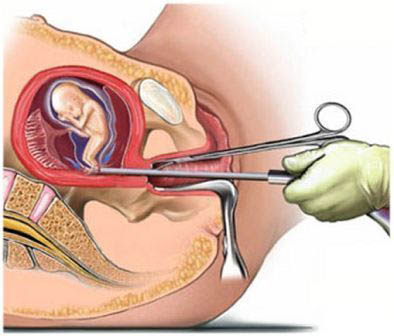 Government Authorised MTP Center